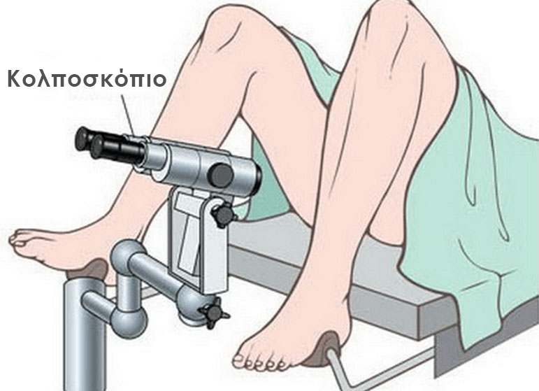 Παθήσεις Τραχήλου της Μήτρας - Νικόλαος Σκαρτάδος Μαιευτήρας – Χειρουργός Γυναικολόγος, Διδάκτωρ Πανεπιστημίου Αθηνών